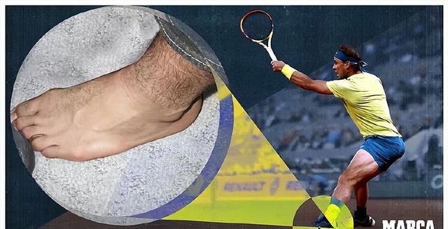 雷速体育-MAD带队取胜！，纳达尔重要时刻重要助攻热度持续攀升(纳达尔 对手)